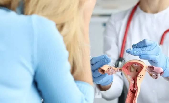 PCOS Treatment